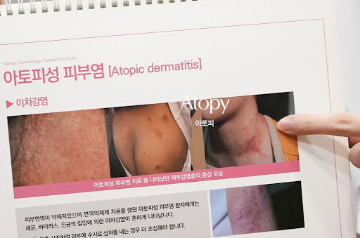 생기한의원이 안내하는 아토피 피부 마찰 줄이는 생활 습관